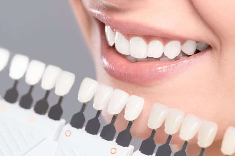 Bleaching And Whitening